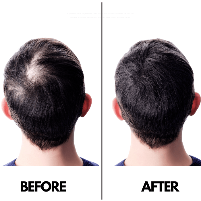 Before and after hair thinning comparison showing fuller look with Knightsmen Grooming Classic organic hair oil.